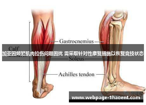 加亚因频繁肌肉拉伤问题困扰 需采取针对性康复措施以恢复竞技状态 加亚因频繁肌肉拉伤问题困扰 需采取针对性康复措施以恢复竞技状态